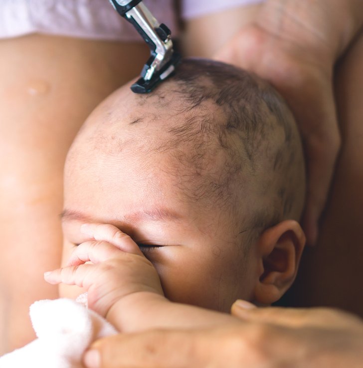 Когда и чем убрать волосы новорожденного