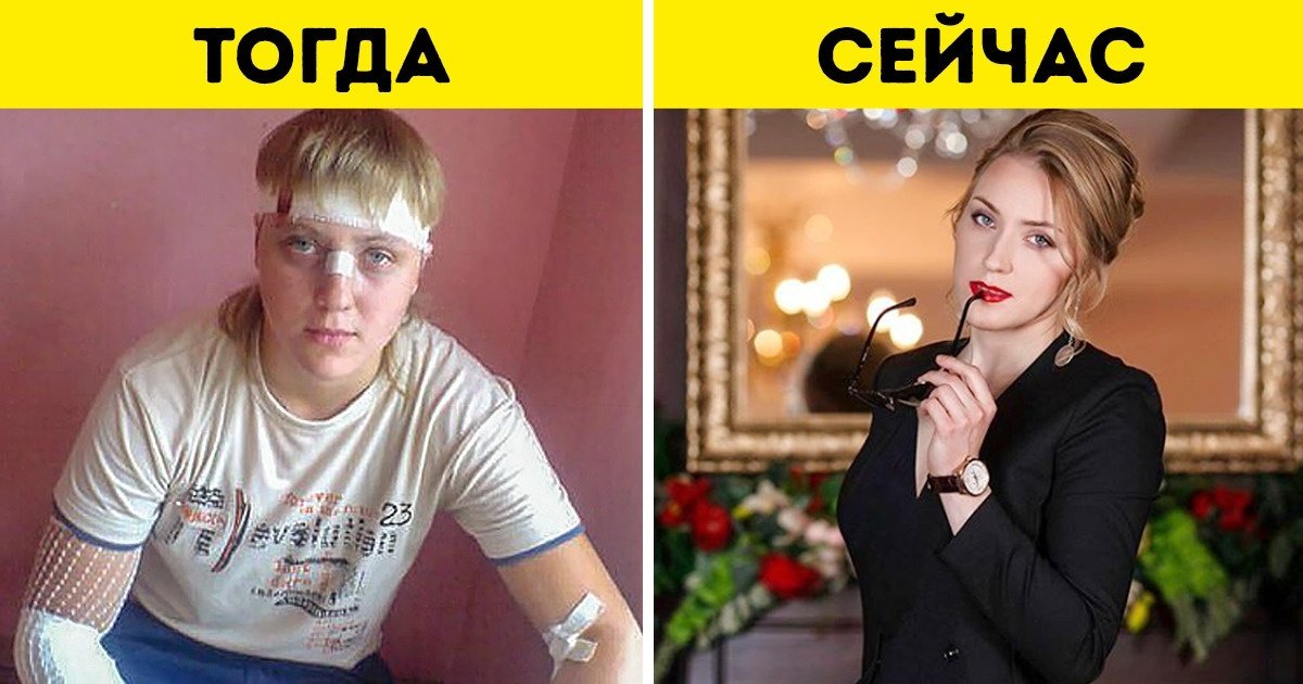 Реальная жизнь героев 1 1. Юля Ковалева до и после проекта. Юля Ковалева до и после проекта пацанки фото.