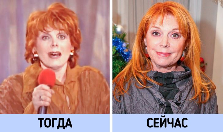 Клара новикова пластические операции фото до и после